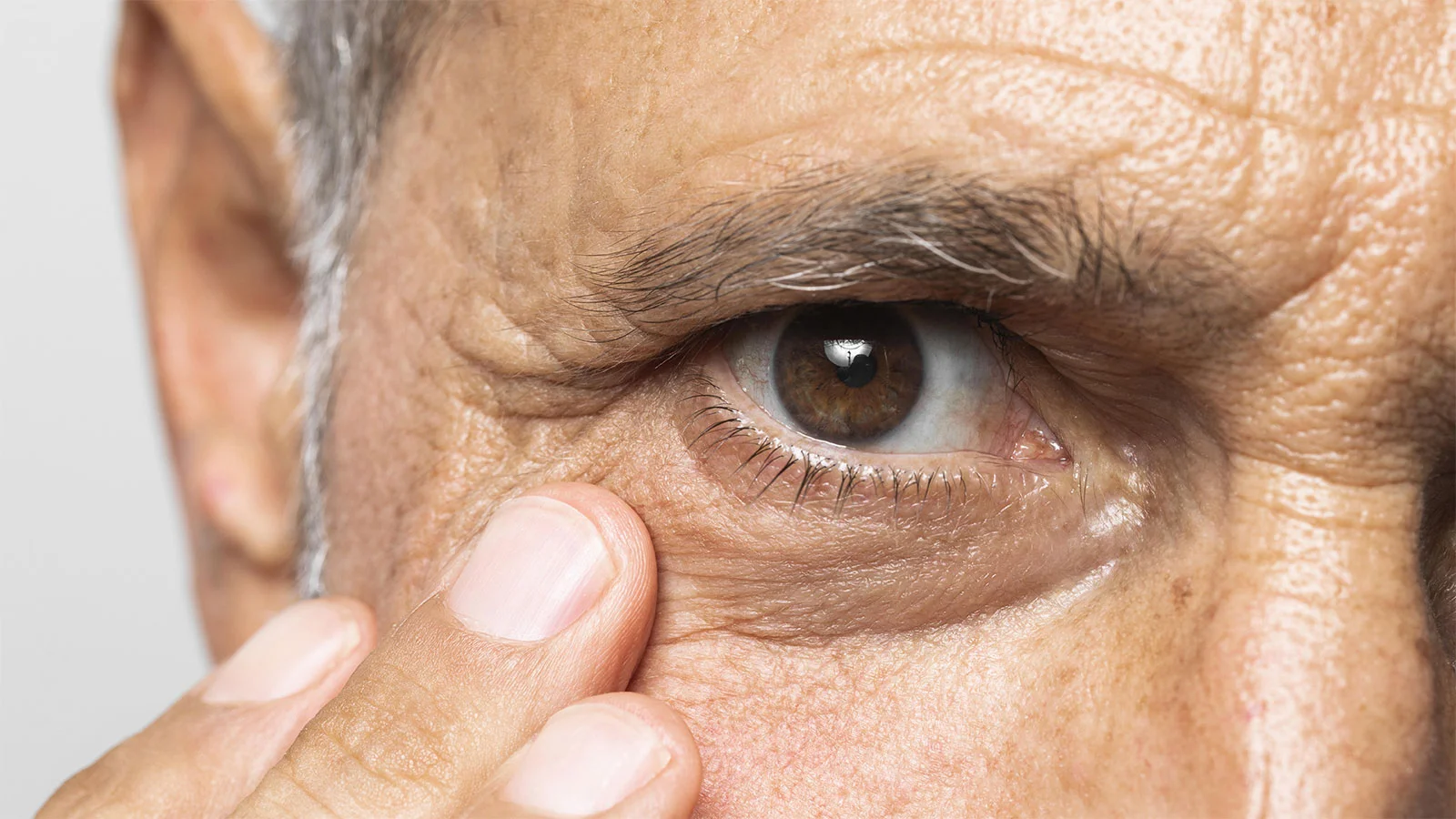 Glaucoma, el enemigo invisible de los ojos